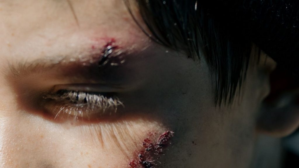 Researchers develop new material to treat wounds, can protect against resistant bacteria