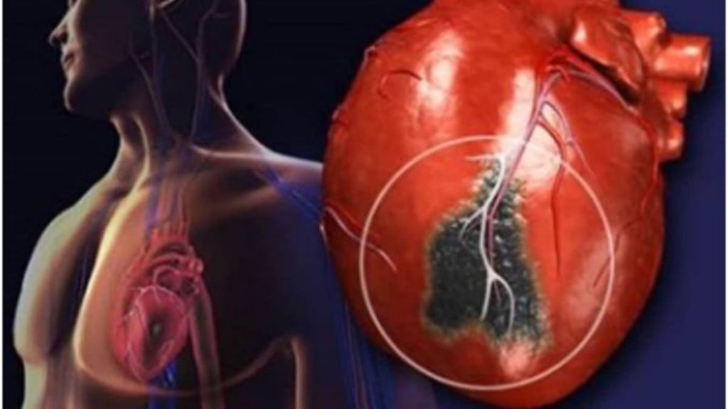 Air pollution linked to high blood pressure, heart diseases in children; study addresses