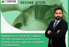 Redefine’s Dr Harikiran Chekuri on hair transplant solutions for women at any age now available in Hyderabad